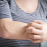 Bite and Die: Scientists Find Way to Poison Mosquitoes Through Human Blood