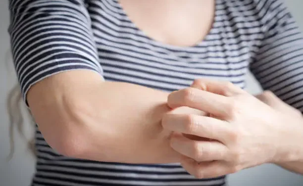 Bite and Die: Scientists Find Way to Poison Mosquitoes Through Human Blood