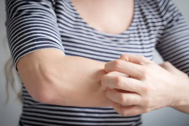 Bite and Die: Scientists Find Way to Poison Mosquitoes Through Human Blood